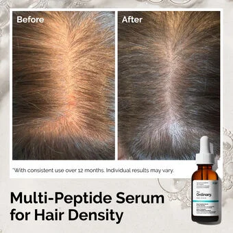 The Ordinary Multi-Peptide Serum for Hair Density - Image 14