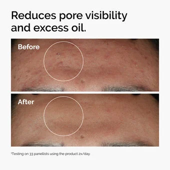 The Ordinary Niacinamide 10% + Zinc 1% — Serum - Image 12