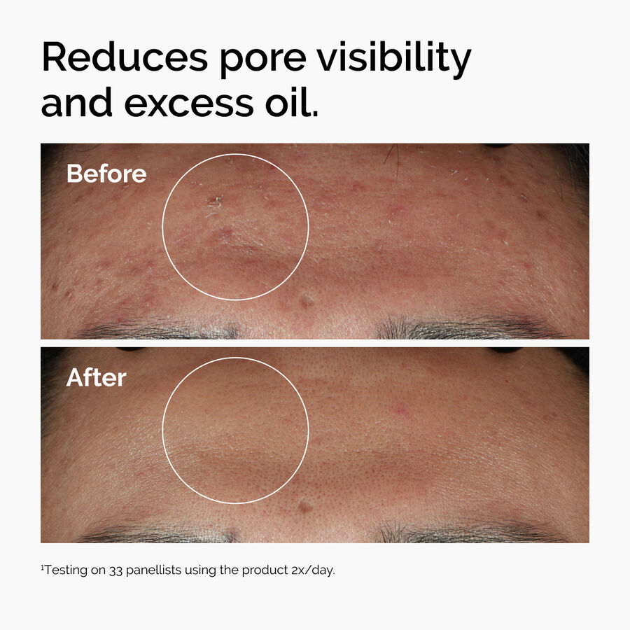 The Ordinary Niacinamide 10% + Zinc 1% — Serum - Image 4